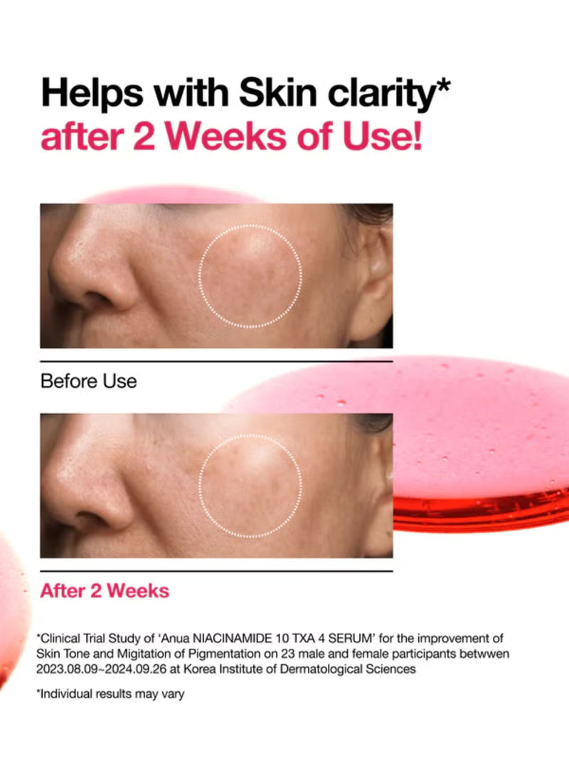 Ramadan Discount Anua Niacinamide Dark Spot Serum / خصم رمضان على سيروم أنوا نياسيناميد للبقع الداكنة